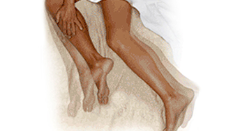 Restless Legs Restless Legs