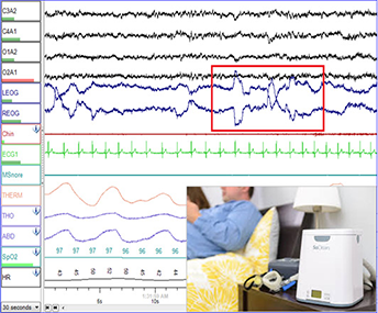 Sleep Diagnostic Machine and Graph Sleep Diagnostic Machine and Graph