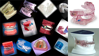 Oral Equipment for Sleep Apnea Oral Equipment for Sleep Apnea